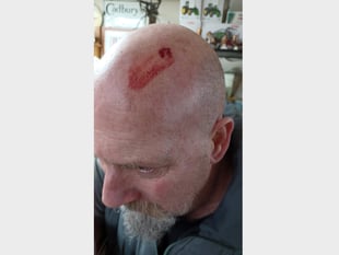 STORM HENK: Man hit by flying debris in Crediton