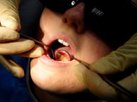 Dozens of hospital admissions in Mid Devon to remove children's rotten teeth