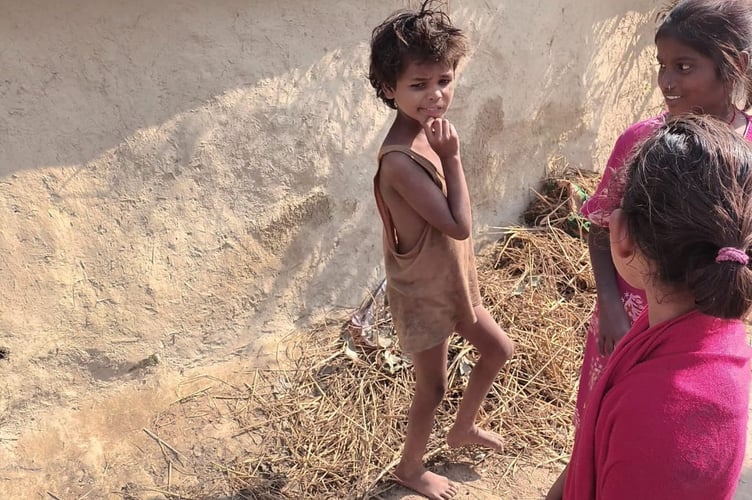 Many Bihari children in remote places show signs of Vitamin A deficiency as a result of poor diet and lack of measles vaccination. This can result in irreversible blindness