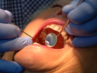  People in Devon more likely to have access to an NHS dentist – as 'postcode lottery' sees thousands miss out
